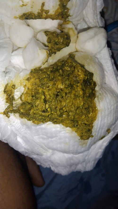 น้อง3เดือน26วัน