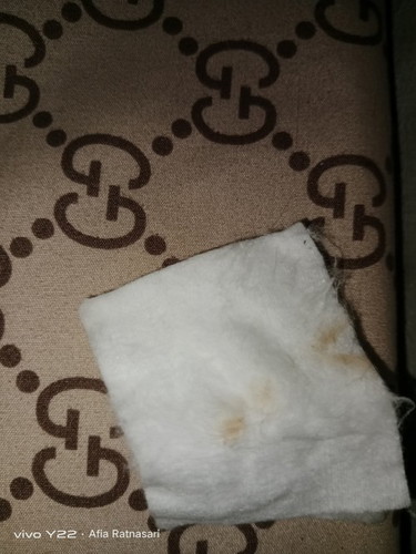 Assalamu'alaikum kak mau tanya kenapa ya kok sering flek? Tapi belom menstruasi
