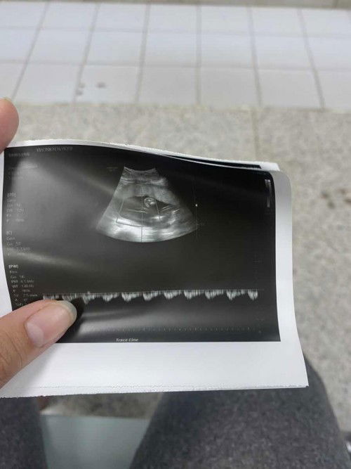 ช่วยดูหน่อยค่ะ ว่าผู้หญิงรึผู้ชาย
#ขอบคุณล่วงหน้าค่ะ