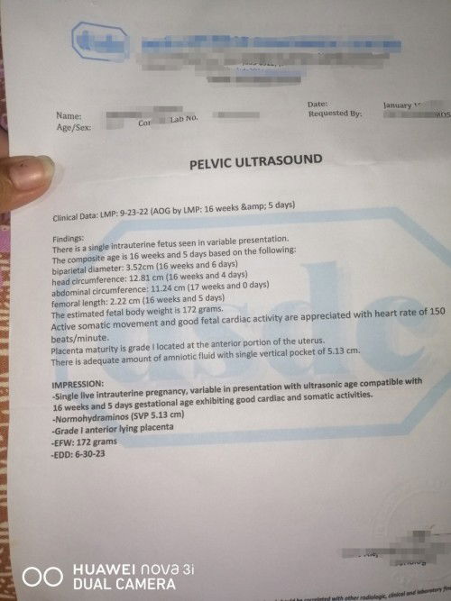 Normal ba results ultrasound ko pati heart beat nya? Kasi martes ko pa malaman balik ako sa ob.