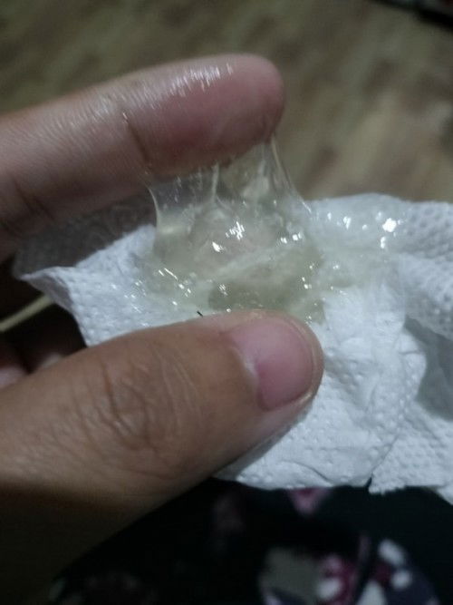 36วีค มีมูกใสออกมาเยอะมาก!!😨