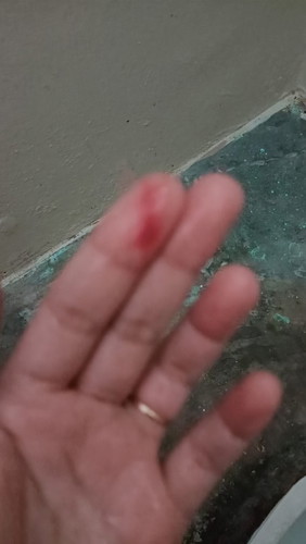 Maaf nak bertanya kenapa saya ada keluar darah lendir ya? Saya baru 5w3D