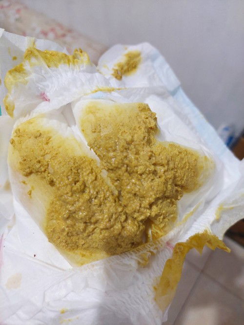 Bayi 0 bulan BAB sehari bs 10x normal kah? Td nya sufor sapi sm DSA di ganti soya. Tp msh sama aja