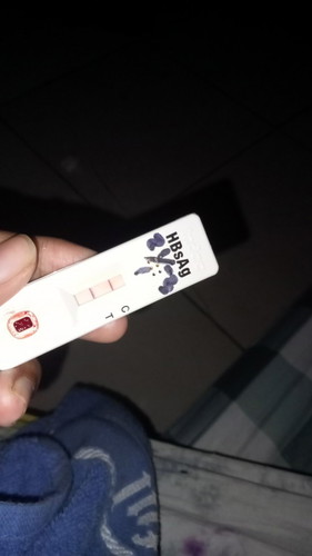 Bunda mau tanya dong, kalo HBsAg positif ada kemungkinan kah buat lahir normal ?