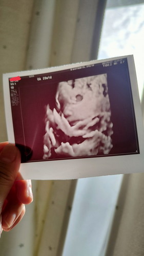 29weeksUltrasound