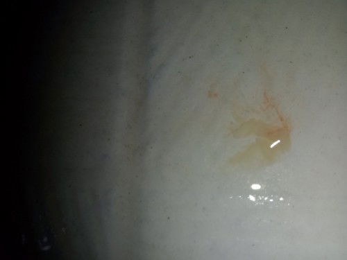 Bertanya tanya,,apakah persalinan semakin dekat ?