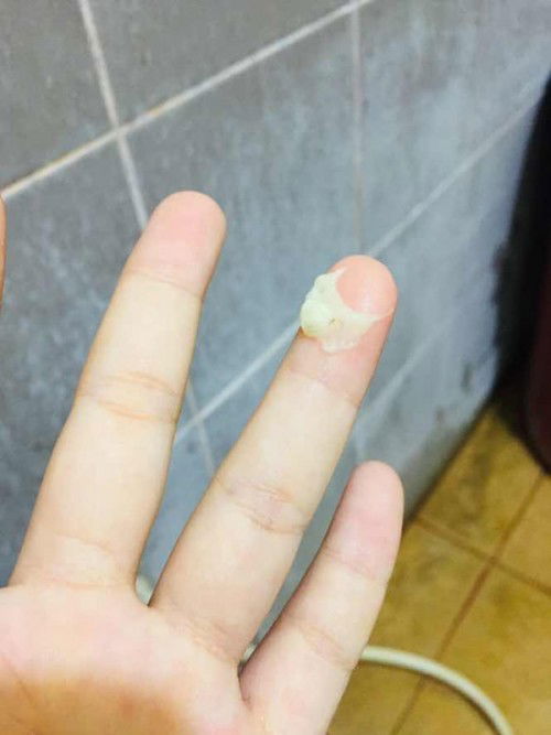 มูกหรือตกขาวอายุครรภ์38+3