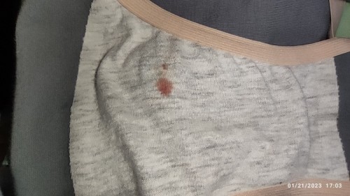 Very Light Bleeding at 26 weeks