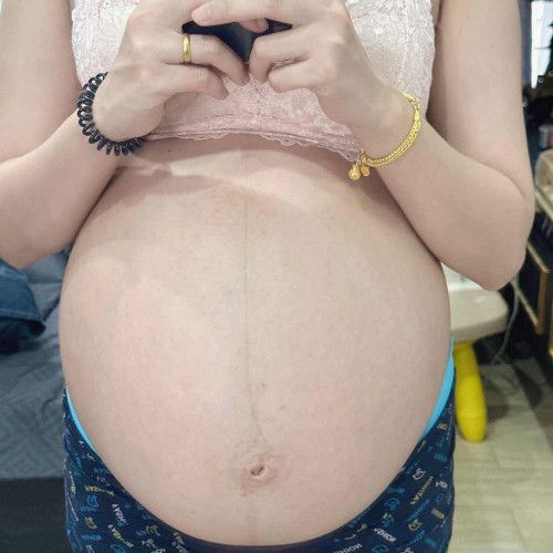 36 week คลอดธรรมชาติ