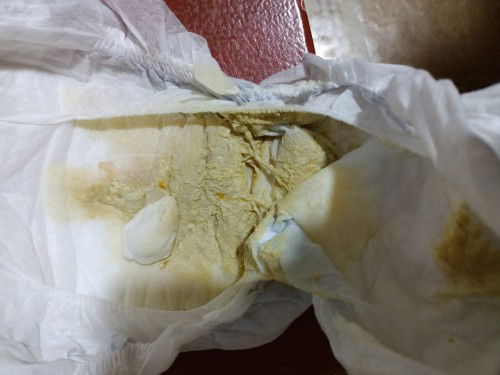 Hello po ask ko lang po if normal lang ba tong poop ng baby ko po. 1st time here po