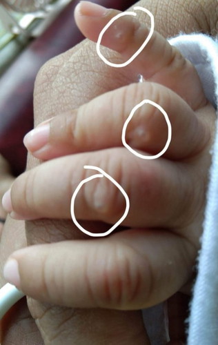 FTM - NP
Anytips po
2 months Baby