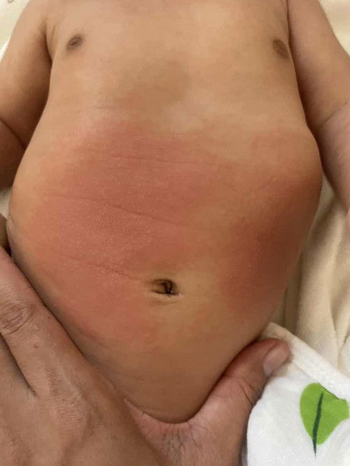 ลูกแพ้มหาหิงค์