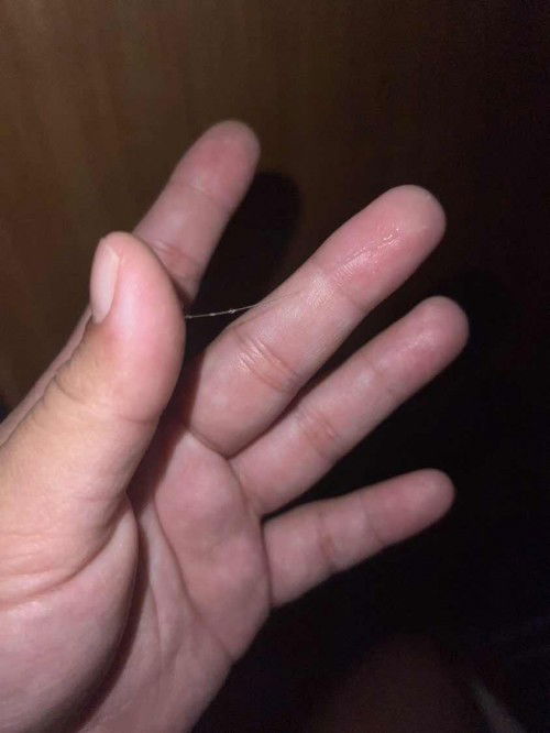 CLEAR DISCHARGE AT 37w, 6days