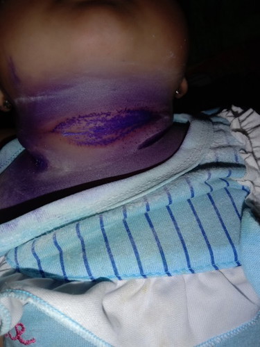 Obat ruam untuk bayi apa ya