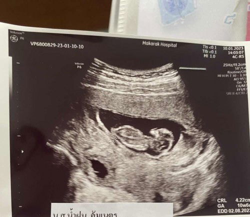 ขอดูภาพเจ้าตัวเล็กหน่อยค่ะ🥰🤍