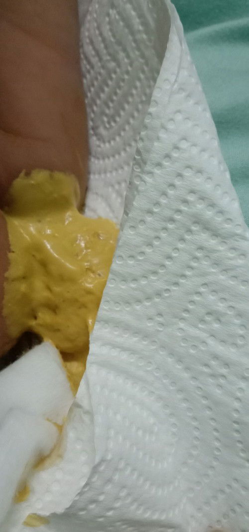 การขับถ่าย