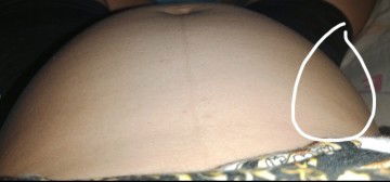 Perut keras di bagian perut kanan