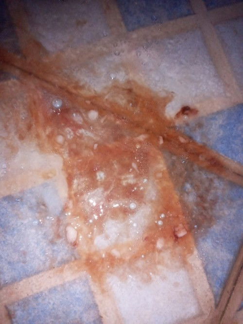 Bun mau tanya ada ga yg muntah darah trs kaya gini, maaf yaa jorok , aku hamil 10w udh 2x rawat inap