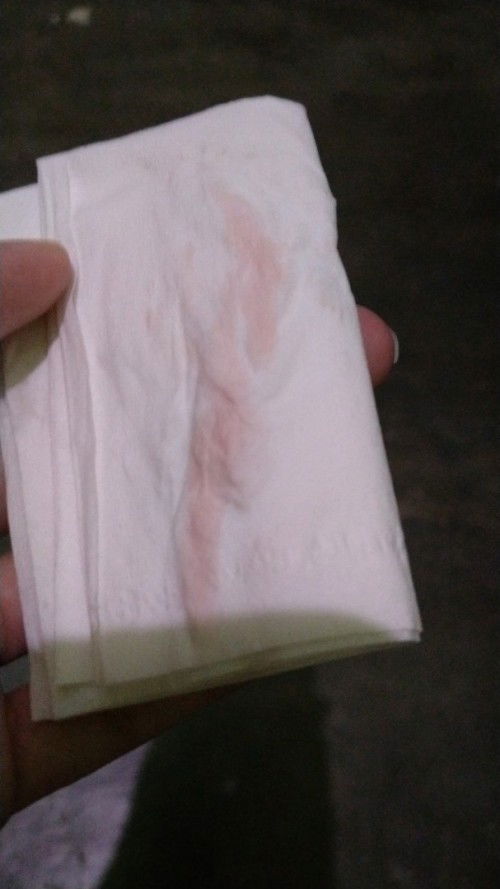 Apakah tanda persalinan?