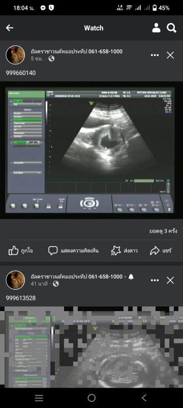 มีสิทธิ์เป็นทัองลมมากนัอยแค่ไหนค่ะ