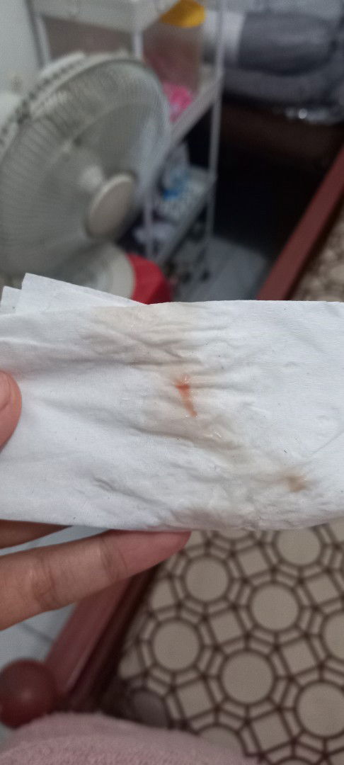 Hamil 38w+4 keluar flek dan darah