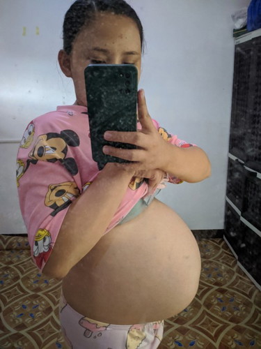 37weeks and 5days