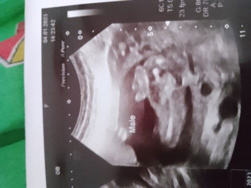 ผู้ชายชัวร์มั้ยคะ