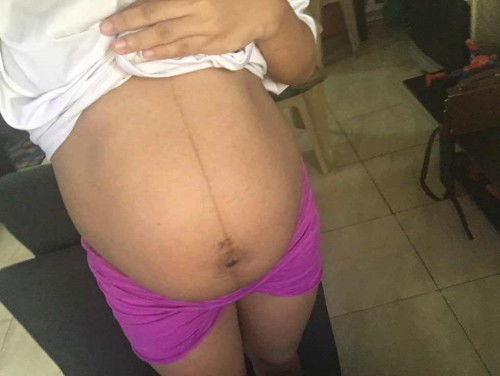 Hello po mababa na po ang tyan ko? 38 weeks na po ako ngayon pero no signs of labor po