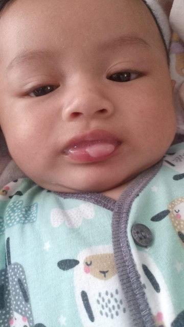 Ada yg bayi nya pernah ngalami kayak gini gx ya sempat panas badan nya ,jadi was2 jg bund2