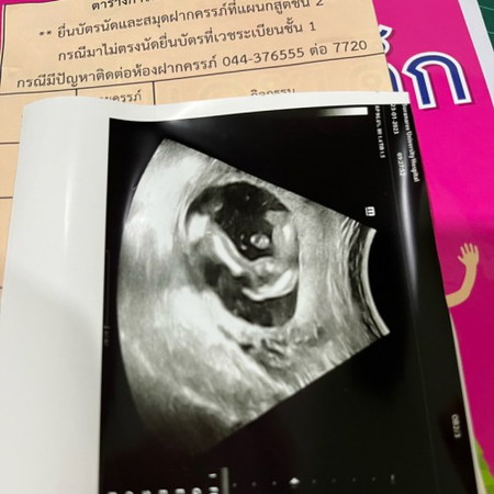 รบกวนแม่ๆช่วยดูให้หน่อยคะ