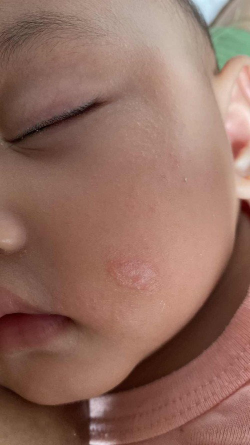 Anak alergi susu sapi