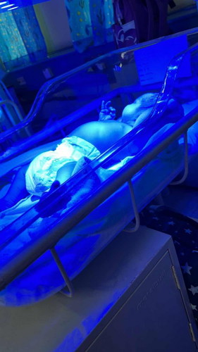 Bacaan Jaundice Tinggi