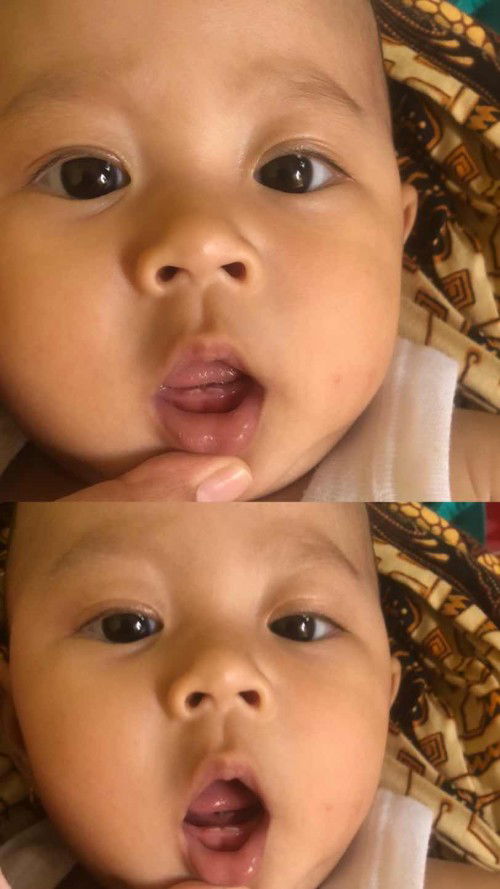 Bayi 4 bulan 18 hari blm bisa tengkurap tp sudah tumgi