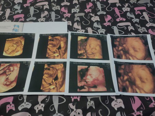 semoga bumil di grup ini sehat semuanya Amin