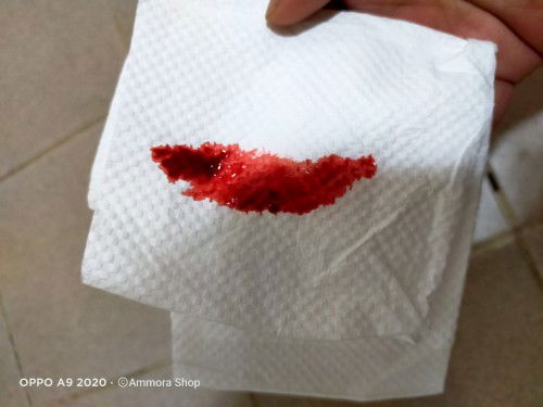 Normal ke spotting mcm ni?