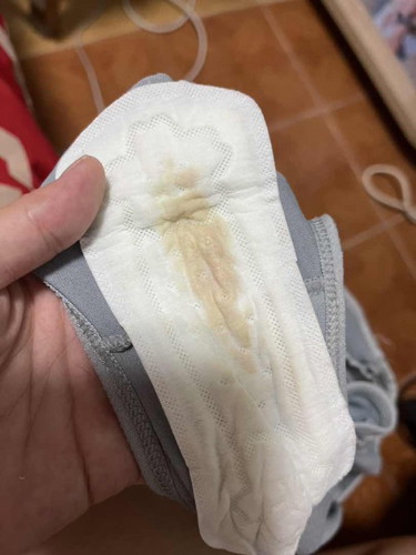 สอบถามอยากทราบค่ะ ตกขาวเปนสีนี้ ท้องได้ 38+4 ใกล้คลอดยังค่ะยังไม่มีอาการเจ็บเลย