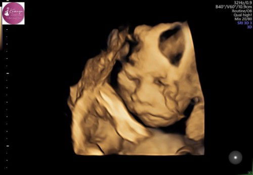 Lg nunggu ade lounching