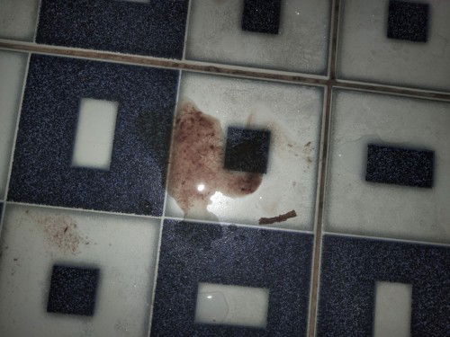 keluar darah coklat gelap