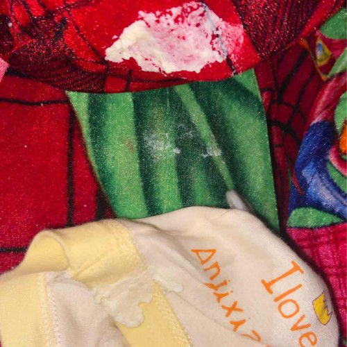 Bé bị nôn trớ nhiều