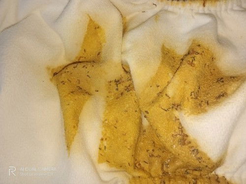 Bun ankku tidak BAB 3 hari . Sekalinya BAB kyak gini kayak ada cacing kecil knpa ya ?