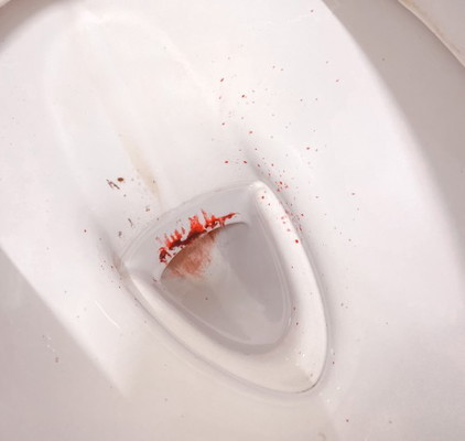 ท้อง 22 Week มีเลือดออก เพราะรกเกาะต่ำ