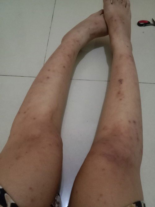 Hamil 7 bulan keluar bintik2 merah trus berbekas hitam