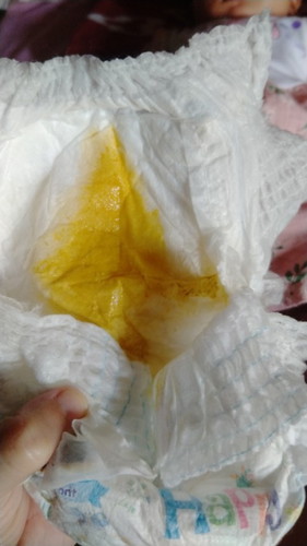Mau tanya bun, bab bayi cair tp ada ampasnya, klo pagi bnyak, klo mlm kdang sedkit, siang 2x bab,