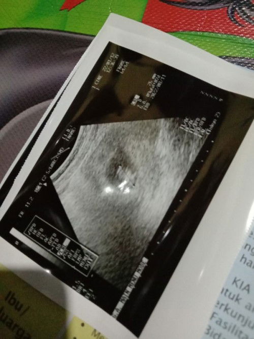 Merasa sangat senang,ingin berbagi cerita