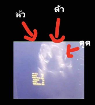 เด็กนอนคว่ำ