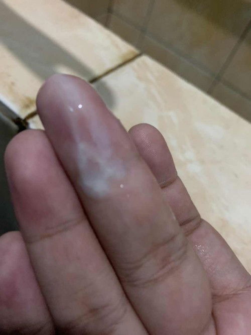 INI KONPAL ATAU KONTRAKSI ASLI YA BUND