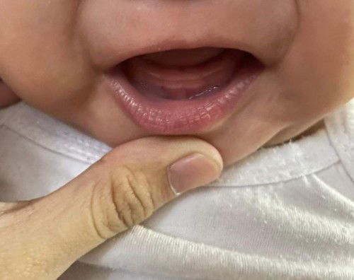 Nagngingipin/ teething