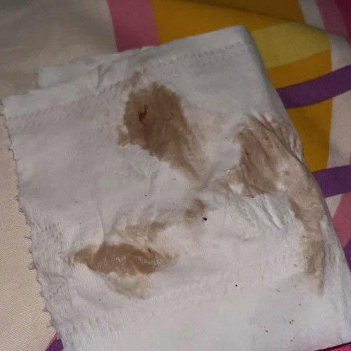 แบบนี้ปกติมั้ยคะ