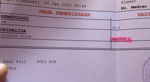 Usia kandungan 36 week