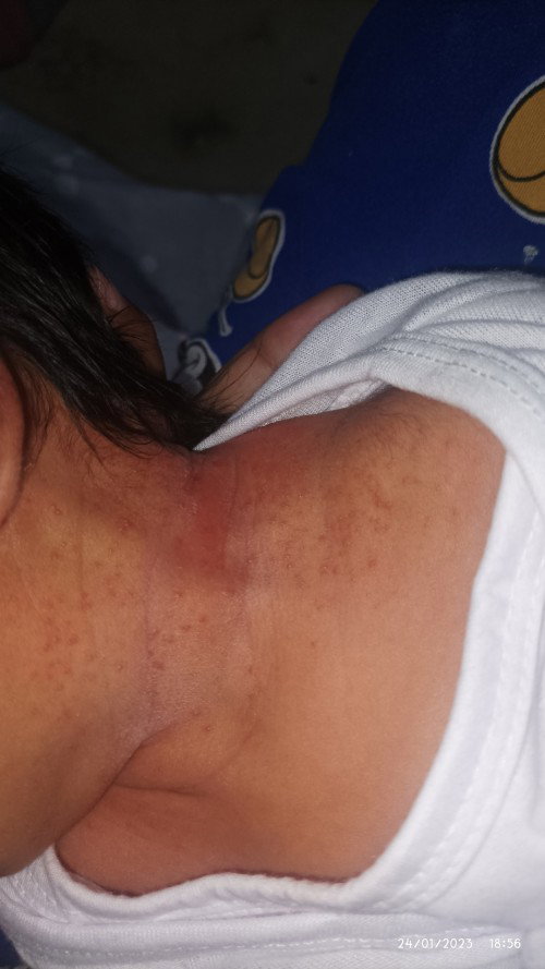 Hello mga mommies, ano kaya gamot sa ganito?